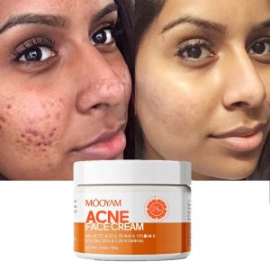 Balukona Label Removal Cream