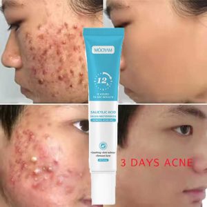 Fast Effective Repair Pimple Scar Anti Spots Removal Gel Smooth Skin Shrink Pores Treatment Cream